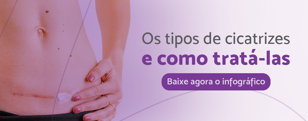 Troca de prótese de silicone: dúvidas, mitos e verdades